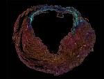 ‘A heart within a heart’, shows damage to the heart in blue after a heart attack