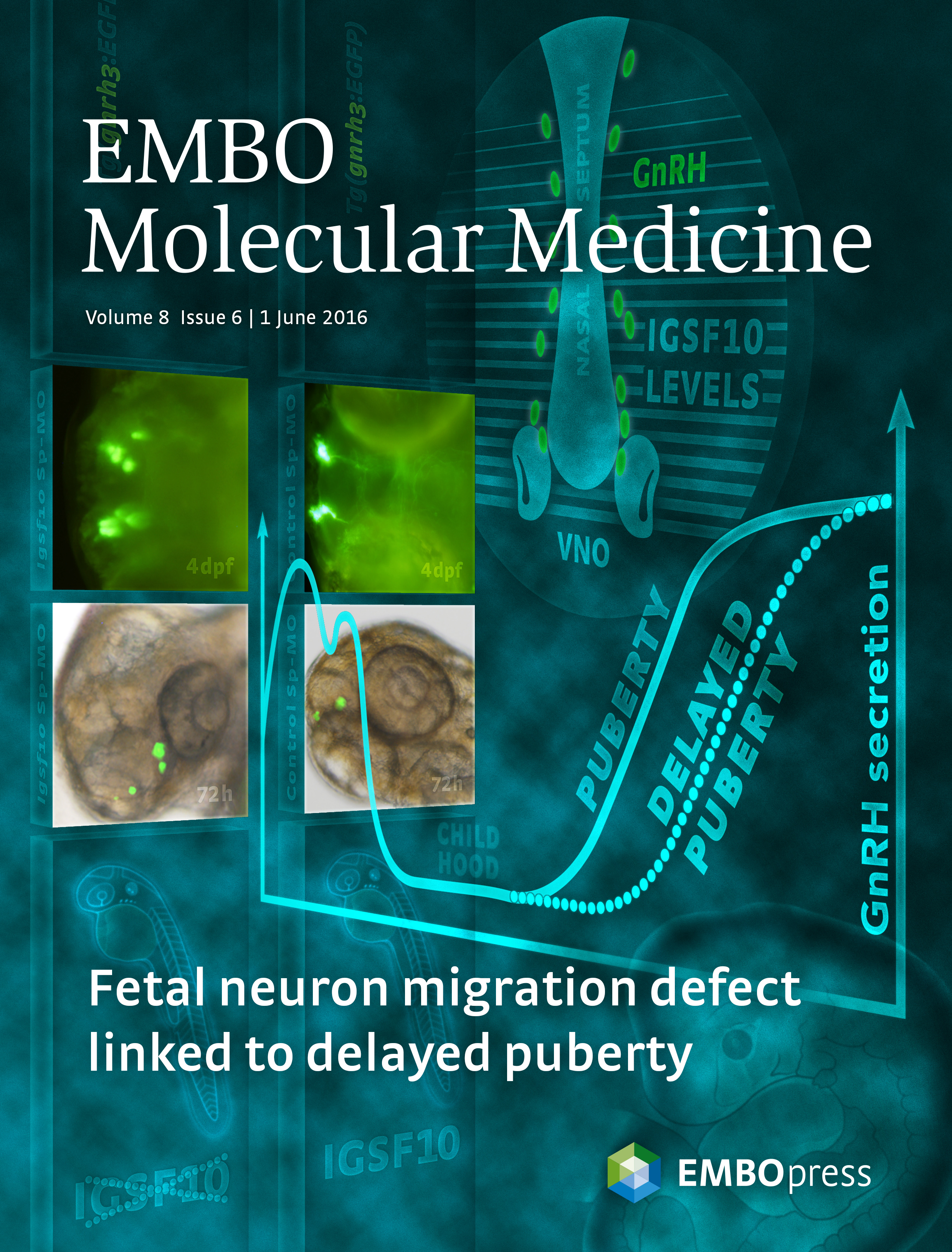 Cover image for EMBO MM journal showing IGSF10 role in neuronal migration